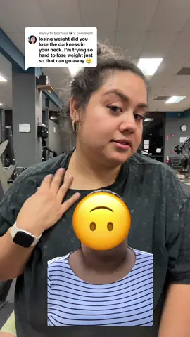 Replying to @EsaYana💀 #weightloss #darkneck #darkneckremedy #Fitness #weightlosstransformation #weightlossprogress #darknecksolution #acanthosisnigricans #insecurities #fyp #GymTok 