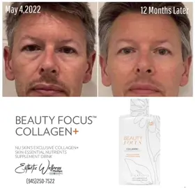 Our Beauty FocusTM Collagen+  Is a clinically proven, proprietary blend of skin-loving ingredients in a delicious drinkable supplement format. • The blend includes • BioactiveCollagenPeptides • Lutein • Phytoceramides BENEFITS 💧🌿 Helps to significantly improve skin texture, radiance, and overall appearance. Significantly boosts scanner score. Helps reduce signs of aging. #collagenpeptides #biostimulator #beautyfocuscollagenplus #beautyfocus #beautyfocuscollagen #youngerlookingskin #jointhealth #glowingskincare #insideoutbeauty #glowfromwithin #radiantskin #youngerlookingskin #moreyouthful #menshealthawareness #womenshealthmatters #cleanbeautyproducts #cleanbeautyrevolution 