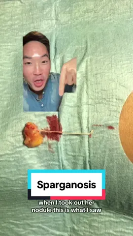 Parasite. #dermatologist #dermatology #drdavidkimderm #skin #infection #parasite #water #rawmeat #raw #losangeles #canberra #brain #greenscreenvideo #greenscreen #LearnOnTikTok #skintok 