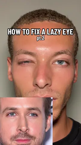 How to fix a lazy eye with different ocular exercises. iB: @Gabriel Dridi #AshtenBarnes #LazyEye #SelfImprovement #MensSelfImprovement #ForYou #EyeExercises 