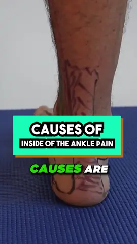 𝐒𝐓𝐀𝐆𝐄 𝟏 𝐈𝐧𝐬𝐢𝐝𝐞 𝐨𝐟 𝐭𝐡𝐞 𝐀𝐧𝐤𝐥𝐞 𝐏𝐚𝐢𝐧 [ 𝐏𝐨𝐬𝐭𝐞𝐫𝐢𝐨𝐫 𝐓𝐢𝐛𝐢𝐚𝐥 𝐓𝐞𝐧𝐝𝐨𝐧𝐢𝐭𝐢𝐬 ]