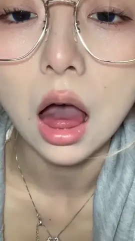 #fypagetiktok #dentistry #oral #beautygirl #fypシ゚viralvideo #lipglossssssssss #fypシtiktoktrending 