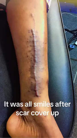 #scary #scar #cover #up #fypシ #viral #foryoupage #amerado #boylyntattoo.Felt happy for making her happy @attaa037 @Wise Saying @Kidi junior @GodSent🦋💟 @💞🤎💜Twerking goddess 💜🤎💞 #utv #tv3 #onuatv 