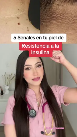 Te dejo el enlace al masterclass gratuito del Dr. Mauricio Gonzales dond ehablara de la diabetes tipo 2 y de como revertir la resistencia a la insulina y prediabetes 👩🏻‍⚕️ en la información de mi perfil e historias de instagram 🫶 #diabetestipo2 #resistenciaainsulina #prediabetes #drmauinforma 