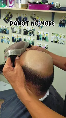 Para to sa mga PANOT jan kaya wag na kayo mag aalala #hairreplacementwig #hairreplacement #wigformen 