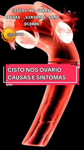 CISTOS NO OVÁRIO CAUSAS e sintomas 