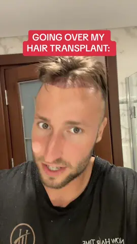 Everything to know about my hair transplant #hairtransplant #hair #hairstyle #haircut #hairtransformation #fypシ 