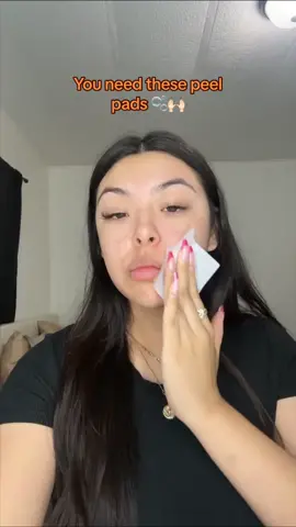 You need these peel pads 🫧 they are amazing!  #drdennisgros #drdennisdailypeel #fyp #universalpeelpads #dailypeelpads #dailypeelpads #peelpads #acneproneskin #exfoliation #dailypeel 
