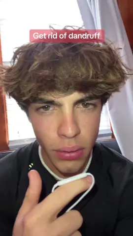 how to geg rid of dandruff ⁉️😱#dillonlatham
