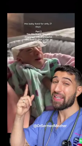 Why This Baby Lived for Only 21 Days #planning Neural tube defects (NTDs) are serious congenital conditions that affect the development of the brain, spinal cord, or their protective coverings. These defects typically occur during the early stages of fetal development when the neural tube, which eventually forms the central nervous system, fails to close properly. One severe form of NTD is anencephaly. Anencephaly is a rare and devastating NTD where a significant portion of the baby's brain, skull, and scalp fail to develop. In cases of anencephaly, the baby is born without the forebrain, leaving them unable to survive for an extended period after birth. Most infants with anencephaly are stillborn or pass away shortly after delivery. Preventing NTDs, including anencephaly, is a crucial aspect of prenatal care. Here's how to reduce the risk of NTDs: Folic Acid Supplementation: Taking folic acid supplements before and during pregnancy significantly reduces the risk of NTDs. Most healthcare professionals recommend starting folic acid supplementation at least one month before conception and continuing throughout the first trimester. Healthy Diet: A balanced and nutritious diet can contribute to a healthy pregnancy. Foods rich in folate, such as leafy greens, fortified cereals, and legumes, can help supplement folic acid intake. Regular Prenatal Care: Early and consistent prenatal care is essential. Your healthcare provider can monitor your pregnancy, offer guidance on nutrition and supplements, and conduct prenatal tests to detect any potential issues. Avoidance of Harmful Substances: Refraining from alcohol, smoking, and illicit drug use during pregnancy is crucial. These substances can increase the risk of NTDs and other birth defects. Management of Preexisting Conditions: If you have preexisting medical conditions or are taking medications, consult with your healthcare provider before becoming pregnant. Some medications and conditions may increase the risk of NTDs. Genetic Counseling: In some cases, a family history of NTDs or other risk factors may necessitate genetic counseling. This can help assess the likelihood of NTDs in your pregnancy. Environmental Factors: Minimize exposure to environmental toxins and radiation, which can increase the risk of NTDs. By following these guidelines and receiving appropriate prenatal care, you can significantly reduce the risk of neural tube defects, including anencephaly, and promote a healthier pregnancy and birth. #NeuralTubeDefects #Anencephaly #PrenatalCare #FolicAcid #HealthyPregnancy #BirthDefectPrevention #MaternalHealth #ChildHealth #GeneticCounseling #NutritionDuringPregnancy #HealthyDiet #PrenatalVitamins #PregnancyAdvice #FolateIntake #BirthDefectAwareness #ParentingTips #HealthyBaby #MedicalScreening #PregnancyWellness #EnvironmentalHealth #FamilyPlanning #fyp #fypシ 