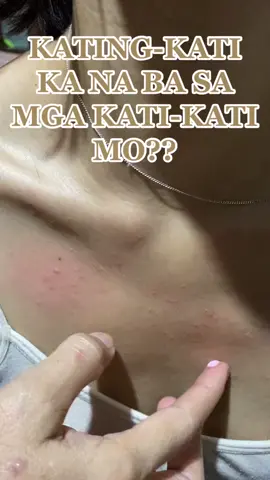 Arturo 2pcs 15g MiaoJia Zudaif#oitment #gamotsakatikatingbalat #pyf #affiliate 