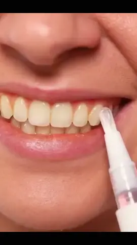 Dazzling Teeth Whitening pen Click the Shop Know Button or got to  my website discounterhub.shop