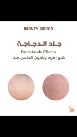 ضروري الترطيب المستمر #تفتيح #يوسرين #عناية_بالجسم 
