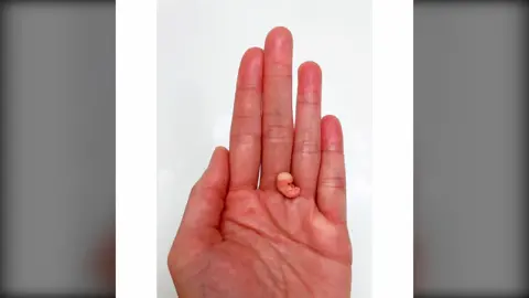 7 Week Gestation Embryo, Stage of Fetal Development (Memorial/Honor Sculpture - Baby Loss, Miscarriage, Keepsake) #7week #7weeksold #7weeks #7weekspregnant #7weekupdate #sevenweek #sevenweeksold #sevenweeks #sevenweekspregnant #baby #babyboy #babylove #babytok #babytiktok #miniature #miniatures #miniaturesculpture #polymerclay #polymerclayartist #polymerclaycreations #clay #clayart #clayartist #prolife #prolife4life #prolifetiktok #babykeepsake #babykeepsakes #babykeepsakeideas #miniaturestuff #miniaturestuff #miniaturesculpture #tiny #tinythings #tinyart #microbaby #polymerclayart #keepsake #keepsakes #keepsakememories #gift #giftideas #gifts #giftsforher #giftshop #giftsformom #babymemorial #babydeath #babydeaths #condolence #condolences #babylife #sculpture #sculptureart #sculptures #sculpturetok #sculptureartist #sculptureoftheweek #sculptureidols #MadeWithLove #madewithlove❤ #madewithlove😍😍😍 #madewithlove❤️😻 #madewithlove❤️ #handmade #handmadegifts #handmadecraft #handmadewithlove #selling #forsale #forsalebyowner #forsalenow #SmallBusiness #smallbusinessowner #smallbiz #smallbusinesstiktok #blackbusiness #blackbusinessowner #blackbusinesswoman #BlackBusinesses #blackbusinesstiktok #blackbusinesswomen #blackbusinessowners #etsy #etsyshop #etsyseller #etsysmallbusiness #etsytiktok #etsybusiness #etsyfinds #etsyshopowner #mercari #mercariseller #mercaricommunity #mercarifinds #ebay #ebayseller #ebayfinds #creation #creations #art #artist #artistsoftiktok #artwork #artistatiktok #arttok #arts #artskills #ArtSkills #artsandcrafts #artstudio #artworks #artwork_daily #artworkontiktok #artworknotartplay #artworkartist #artworkshop #artworksontiktok #artworks_artist #artworkshops #abortion #abortions #babyloss #babylosscommunity #babylosskeepsake #embryo #embryos #omg #amazing #amazingvideo #amazingfinds #wow #omggggg #omgg #omggg #amazingart #amazingartist #amazingartwork #amazingartists  #amazingartwork❣ #amazingartworld #amazingarts #amazingartistalert #amazingartworks #wow #wowww #woww 