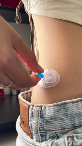Trocando a canula da minha bomba de insulina #diabetes #dm1 #diabetestipo1 #diabetico #endocrinologia 