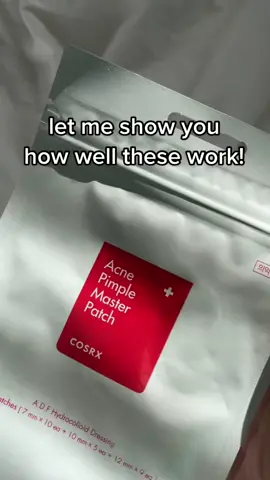 COSRX Master Patch Original Fit- Absorbing Hydrocolloid Spot Treatment Pimple Spot Stickers. How to Use:  1. Cleanse the area around the problem spot.  2. Select a bigger size patch than the problem spot and attach the patch to the spot.  3. If patch appears white and full, remove and put on a new patch. #cosrx #cosrxbestseller #cosrxdermskincare #skincare #skincareroutine #skincaretips #skincareproducts #acne #acnetreatment #acneskin