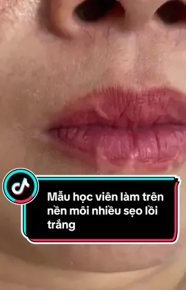 Học viên lên mẫu ca môi sẹo ,bạn nẫu mong muốn đậm màu để che đi #hathubeauty #tiktok #phunxam #lamdep #xuhuong #phunmoi 
