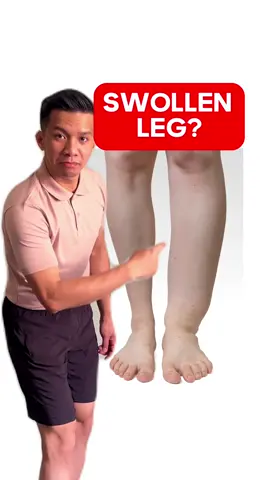 🦵 Say goodbye to swollen legs with these effective exercises! 💪  Hit ❤️ if you found this video helpful!  👉FOLLOW FOR MORE REMEDY TIPS!  📚 Swollen legs can occur due to various reasons, including fluid retention, injury, inflammation, or underlying medical conditions such as heart, kidney, or circulatory problems. #legday #legworkout #edema #swelling #LegEdema #physicaltherapy #physiotherapist #trendingvideo #legedema #swollenleg #restlesslegsyndrome 