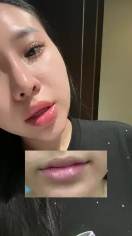 Tinh chất giảm thâm môi hiệu quả mà Thi dùng, nay môi hồng lắm hihi 😛 #langngocthi #dcgr #yuvias #reviewlamdep 