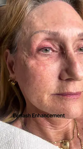 #esthetician #SemipermanentBrows #PermanentCosmetics #Semipermanent PermanentCosmetics #Semipermanent #MicrobladingEybrows #microblading#tatto#eyelinertatto#eyelinerEnhancement#lipblushing#liptatto#tatto# eyeliner#makeup#dermaplaning #dermabrasion #SemipermanentBrows #PermanentCosmetics #Semipermanent #MicrobladingEybrows #microblading#tatto#eyelinertatto#eyelinerEnhancement#lipblushing#liptatto#tatto# eyeliner#makeup