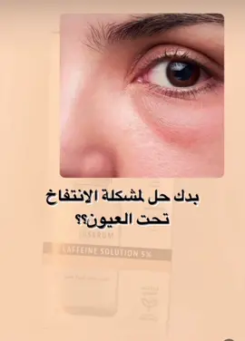 المنتج الذي يحتوي على  المكون السحري محلول كافين بتركيز 5٪ ، يقلل من ظهور الهالات السوداء وأكياس تحت العين 🌸   تمت دراسة المنتج وفحصه والمواففة عليه من قبل وزارة الصحة ✔️ طريقة الاستخدام :  يوضع مرتين يوميا على محيط العين الجافة بحركات دائرية لطيفة . اتركي السيروم يمتصه الجلد قبل وضع المرطب 😍😍😍#skincare #skincaretips #skinhealth #palestine #palskin #cosmo #pharm #pharmacy #hair #haircare #HairCareTips #hairproducts #skincareproducts #فلسطين🇵🇸 