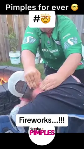 #pimples #cyst #pimple #horror #medical #blackhead #bigpimple #pimpleremoval #disgusting #pimplepop #squeeze #skincare #acne #verysatisfying #abscess 