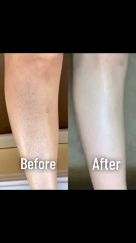 Follow us sissy 💓#TikTokAwardsPH2023 #LearnItOnTikTok #lotion #skin 