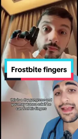 He can’t feel them #medicine #medical #medtok #frostbite #gangrene 