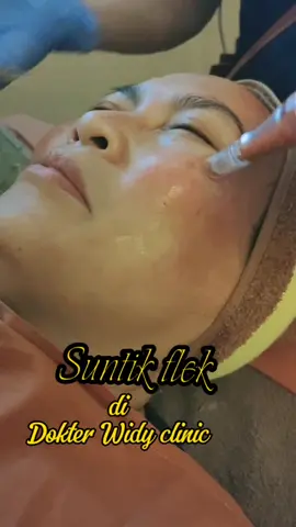 Menghilangkan flek dan mencerahkan kulit wajah di dr Widy Clinic 😍💪😍 #drwidyclinic #klinikkecantikan #solusiflek #obatflek 