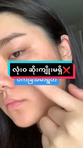 ဝက်ခြံအမာရွတ်အတွက်#amormyanmar #amorဆရာဝန်ထုတ်မျက်နှာသစ်💦💦💦 #htetaung772023 #ဝက်ခြံအမာရွတ်သမားများအတွက် #ချွေးပေါက်ကျယ်နေတဲ့သူတွေအတွက် #အဆီဖုတွေသက်သာချင်မှဝင်ကြည့် 