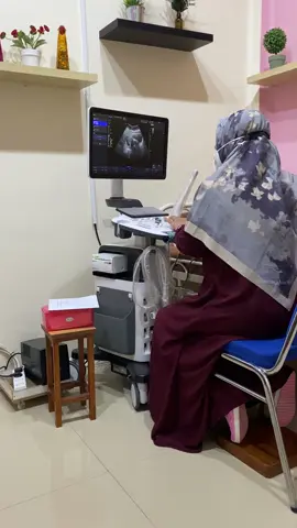 Subhanallah pertama kali mendengar detak jatungmu nak 🫶. Bismillah sehat sehat #usg #7weekspregnant #pejuanggarisdua