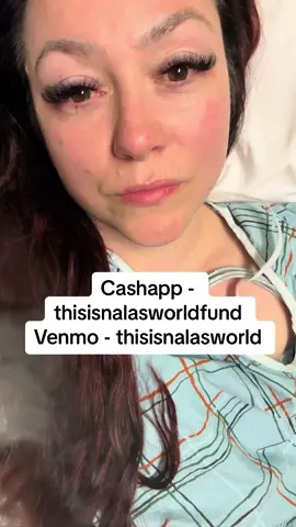 Send prayers please! #thisisnalasworld #fyp #prayers #prayersneeded 