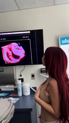 Vemos a nuestro bebé por primera vez 🥹🤍 VIDEOCOMPLETO:CANALNICOLLEFIGUEROA