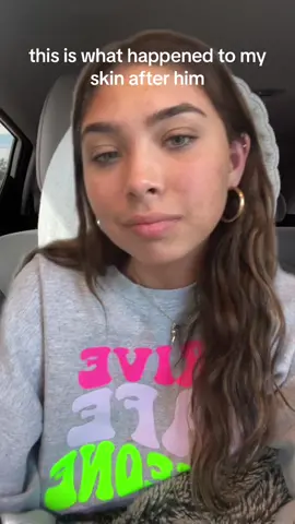 theta d1e #ihatepsoriasis 