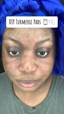 Great results 👍🏾🫧 #fypシ゚viral #fypシ #trendy #viral #zyxcba #tumericpads #diyathome #baddiesonabudget @La Selva Beach Spice 