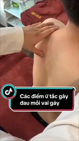 Các điểm ứ tắc gây đau mỏi vai gáy #xuhuong #đauvaigáy #duongsinhdongy #yvien 