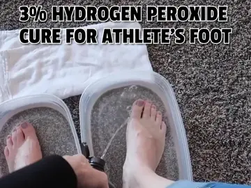 #hydrogenperoxide #athletesfoot #footfungus #toenailfungus #footodor #footodour #athletesfootsurvivor #athletesfoottreatment #athletesfooteducation #athletesfoothack #smellyfeet😔 #nailfungus #nailfungustreatment #nailfungusremedies #nailfungusrelief #itchyfeetfoodies #itchyfeetremedies #callusremoval #callusremover #callustreatment #calluses #callusedfeet #callusedfoot #fungalinfection #fungalnail #fungaltoenails #fungalnails #antifungal #footsoak #footsoaktherapy #footsoaktip #footcareroutine #footcaretips #footcaretreament #footcareproducts #footcarenurse #footinfection