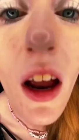 Yellowest Teeth In The World VS Orthodontist#fyp  #foryou  #viral  #trending  #funny