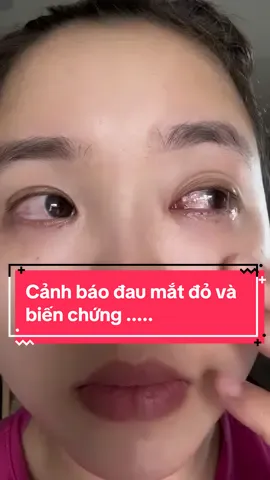 Các bác bị đau nên đến bệnh viện khám cho chắc ăn nhé. Đừng như em 😭😭😭#daumatdo 