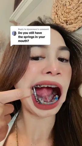 Replying to @kjonnmars YES #answer #answeringcomments  #fyp #fypシ #fypシ゚viral #fypage #foryou #foryourpage #foryoupageofficiall #xyzbcafyp #philippines #california #zairamonzon #pinay #tiktokphil #tiktok #foryoupage❤️❤️ #pink#herbst #herbstappliance #brace #tads