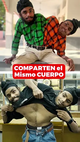 Hermanos Comparten El Mismo Cuerpo #shorts #tik_tok #top #viral