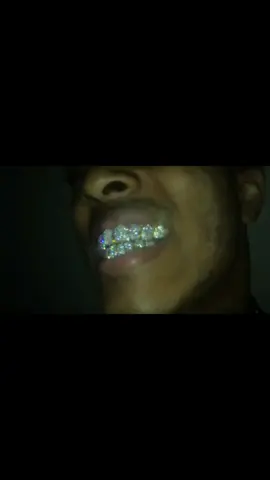 X showing off his grillz .                                                              ..                          ..                                                   ..                          ..                    ..   #xxxtentacion #jahsehonfroy #ripx #llj #xyzbca #zyxcba #viral #fyp #xxxtentacionfan 