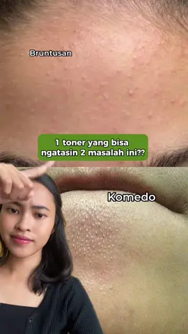 Manfaatnya banyak banget! Wajib punya toner ini ‼️💥 Langsung tap link di bio 💨 #RacunTikTokAvoskin #refiningtoneravoskin #eksfoliasi 