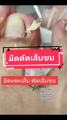 #เล็บขบ #มีดตัดเล็บขบ #ตัดเล็บขบ #ของใช้ในบ้าน #tiktokshopครีเอเตอร์ @ของกิน ของใช้ในบ้าน @ของกิน ของใช้ในบ้าน @ของกิน ของใช้ในบ้าน 
