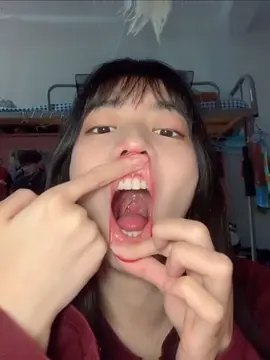 #fypagetiktok #Tongue #dentistry #fypシ゚viraltiktok #randomasmr #smoothlips 