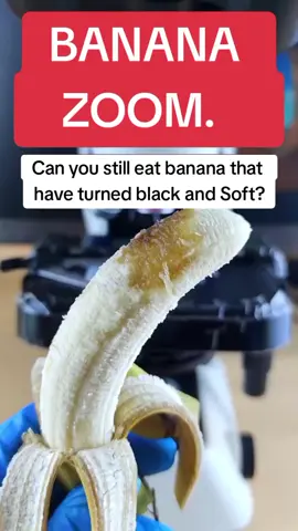 How do Blackened Banana look like under microscope