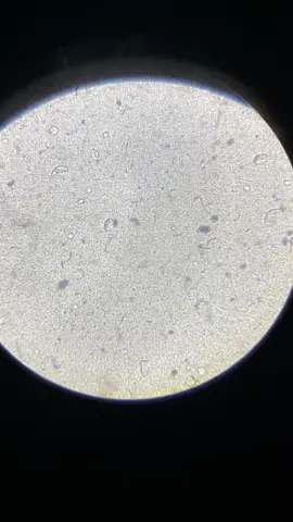 live good bacteria under microscope🦠🔬👍🏻 #yakult #microscope #goodbacteria 
