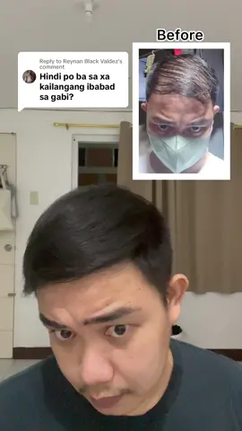 Replying to @Reynan Black Valdez Anytime of the day po as long as maibabad natin sa ulo ng minimum of 4hrs. Huwag din po natin kalimutan na iwash muna ang ating buhok bago mag apply ng Minoxidil Strands. #minoxidil #minoxidilstrands #hairgrower #hairgrowthtips #baldnesscure #naglalagasnabuhok #minoxidilparasamalapadnanoo #gamotsanaglalagasnabuhok #LearnItOnTikTok #viralvideo 