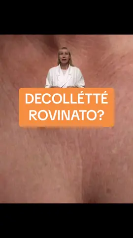 Hai il decollétté rovinato da rughe, macchie scure, secchezza cutanea per eccessiva esposizione solare o perche la tua pelle non è piu giovanissima? Ti mostro cosa utilizzare per ristrutturare la tua pelle e migliorare il suo l’aspetto in modo tale che tu ti senta orgogliosa e tranquilla di indossare abiti scollati senza doverti coprire con foulard o colli alti.  #curadellapelle #colloedecollete #decollete #greenscreen #skincaretips #alfaidrossiacidi #acidomandelico 