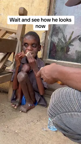 Hunger is serious and the cure is food, please choose to stand with us so that we can be able to provide the starving children with food, donate if you can  #fyp #fypviral #foryoupage #streetchildren #makingworldabetterplace #savealifeforfuture #katonicodem #fypシ #fypシ゚viral #germany #usa #luxunburg #Brazil #England 